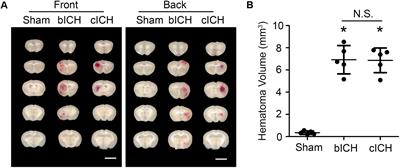 Expression of Tmem119/Sall1 and Ccr2/CD69 in FACS-Sorted Microglia- and Monocyte/Macrophage-Enriched Cell Populations After Intracerebral Hemorrhage